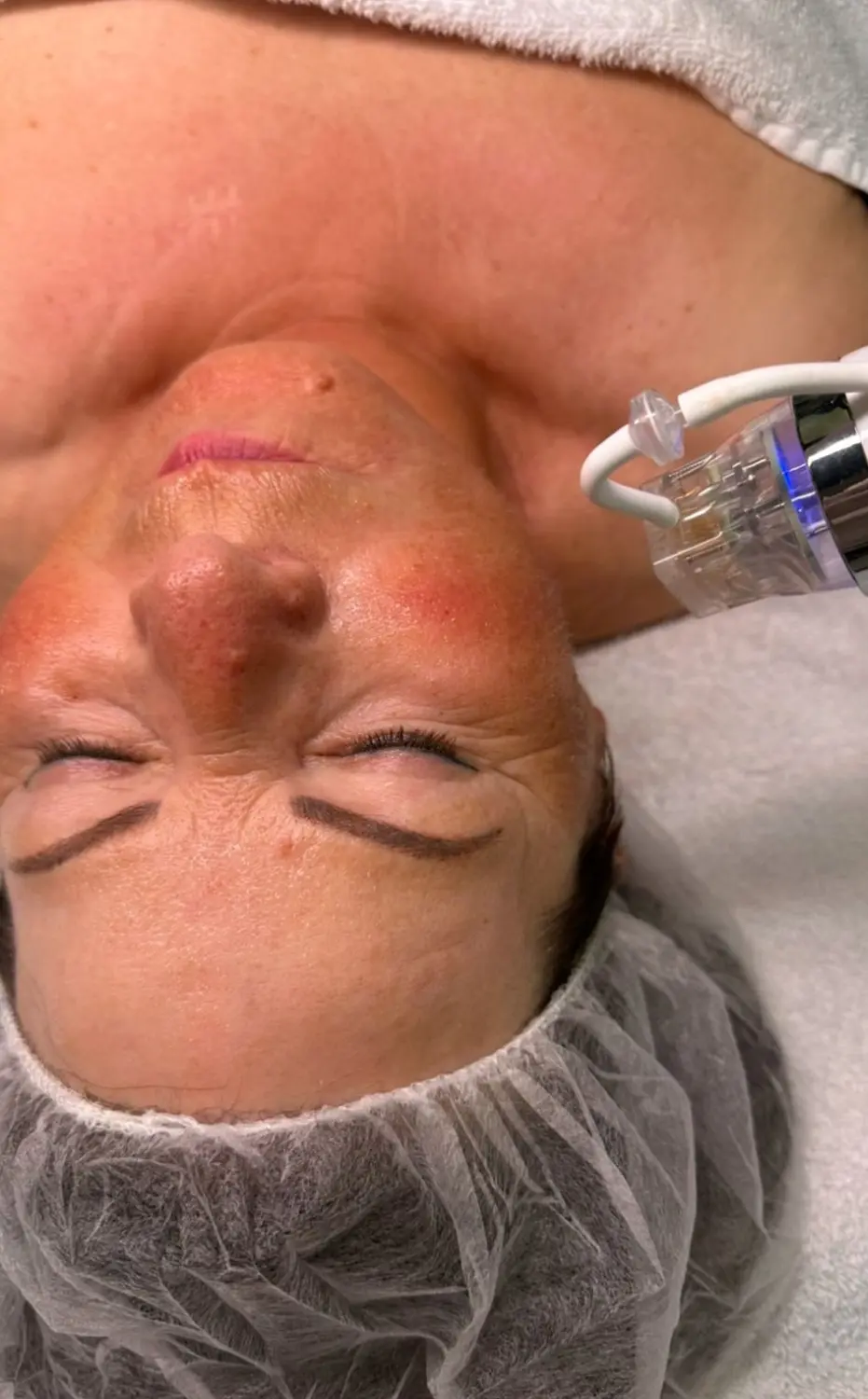 BEAUTY NAILS DELUXE - Radiofrequenz