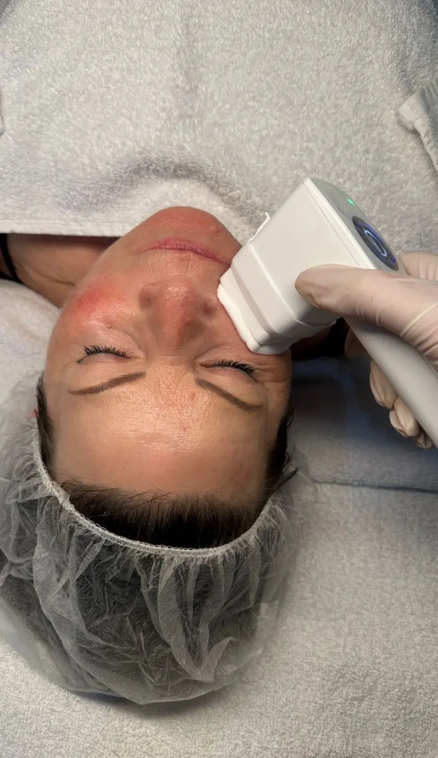 BEAUTY NAILS DELUXE - Radiofrequenz