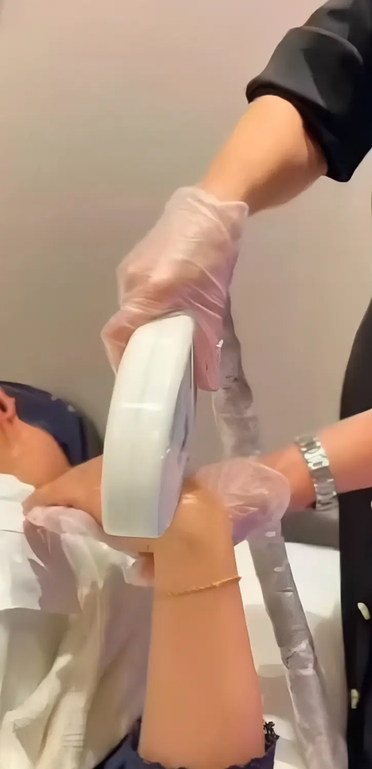 BEAUTY NAILS DELUXE - Dauerhaft haarfrei